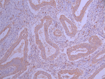 IFNGR1 Antibody