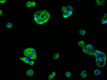 IFNGR1 Antibody