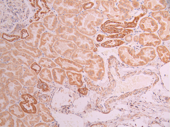 TOMM20 Antibody