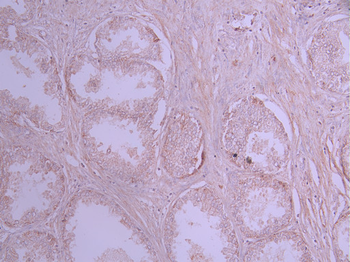 HK1 Antibody