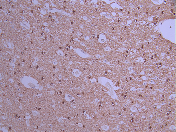 TPPP Antibody