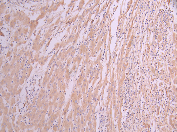 ACADM Antibody