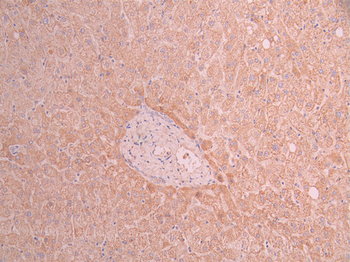 ACADM Antibody