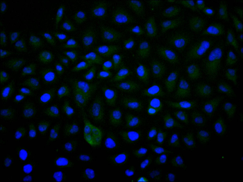ACADM Antibody