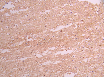 CEND1 Antibody