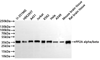 PPP2CA&PPP2CB Antibody