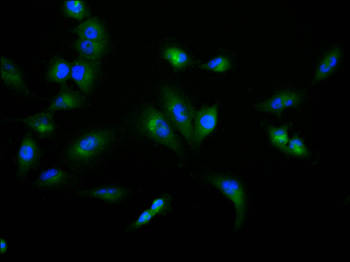 PPP2CA&PPP2CB Antibody