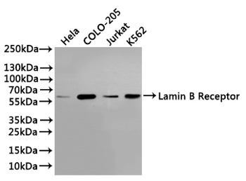 LBR Antibody