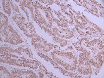 LBR Antibody