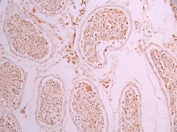 RPS6KA6 Antibody