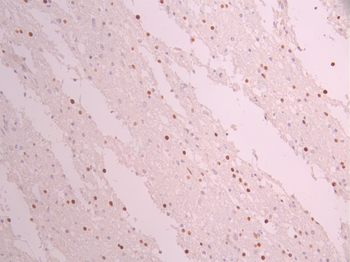 CCNE2 Antibody