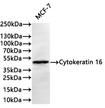 KRT16 Antibody
