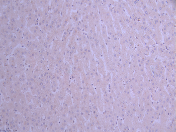 TNNI3 Antibody