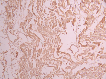 TNNI3 Antibody