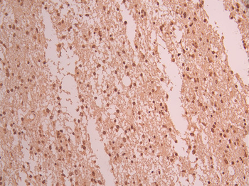 IKZF3 Antibody