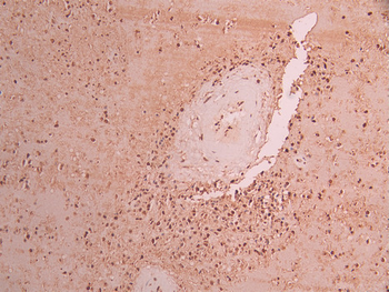 IKZF3 Antibody