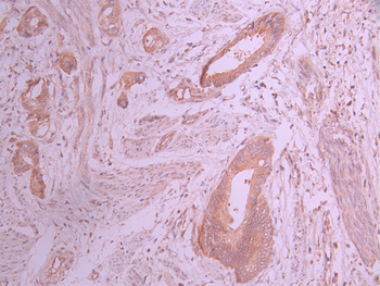 TYRO3 Antibody
