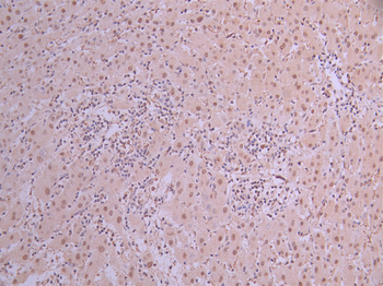 PSMA2 Antibody