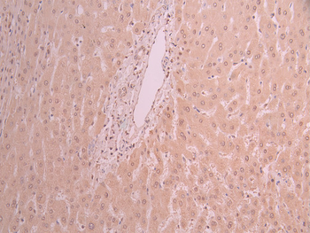 PSMA3 Antibody