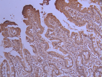PSMA3 Antibody