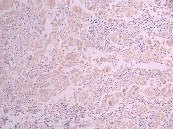 MB Antibody
