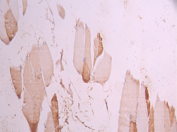 MB Antibody