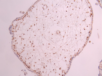 CHEK2 Antibody