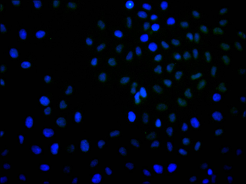 CHEK2 Antibody