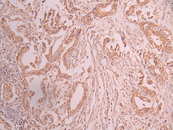 CAPNS1 Antibody