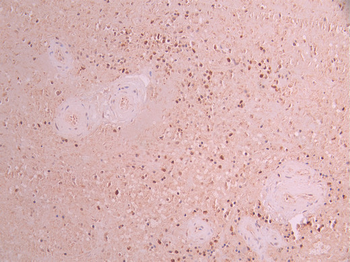 KITLG Antibody
