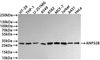 ANP32B Antibody