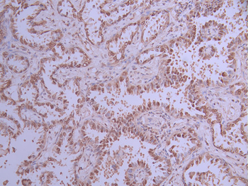 ANP32B Antibody