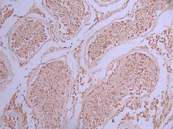 ANP32B Antibody