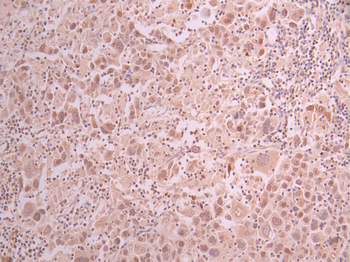 SLC29A2 Antibody