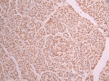 SLC29A2 Antibody