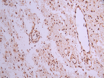 DDX39B Antibody