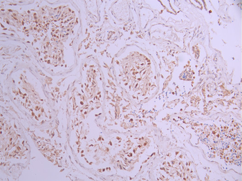 DDX39B Antibody