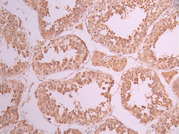 NFKBIB Antibody