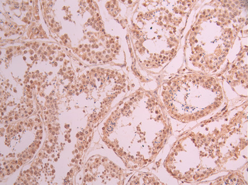 PRPF19 Antibody