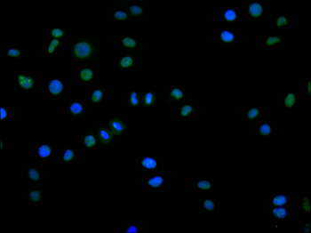 DDX17 Antibody