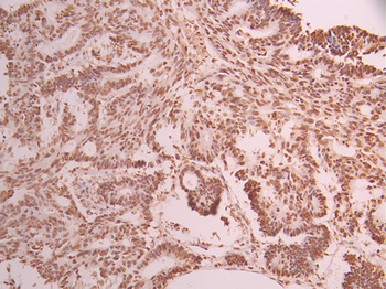 ZBTB7A Antibody