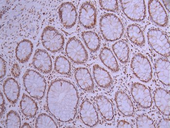 ZBTB7A Antibody