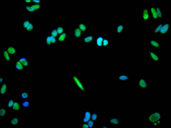 ZBTB7A Antibody