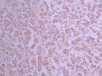 GART Antibody