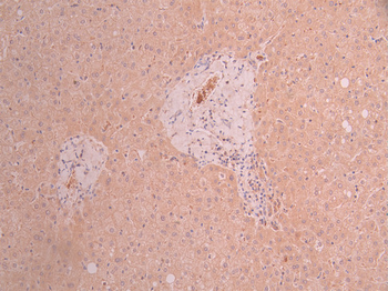 GART Antibody