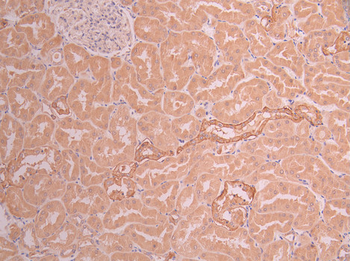 TMPRSS2 Antibody