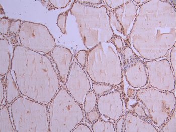 KDM4B Antibody