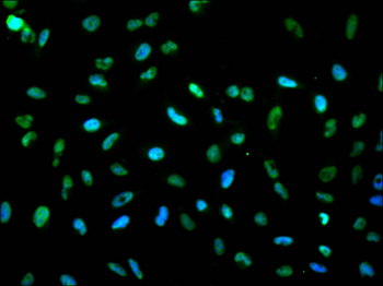 KDM4B Antibody