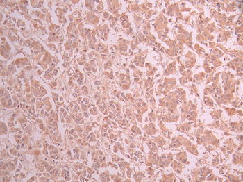 ADIPOR1 Antibody