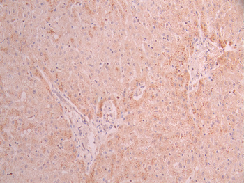 ADIPOR1 Antibody